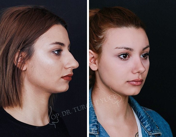 Онлайн изменить нос на фото онлайн
